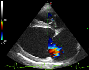 MyLabClassCVET-Cardio-CFM