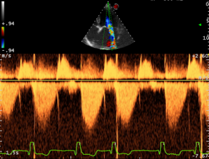 MyLabClassCVET-Cardio-CWdoppler